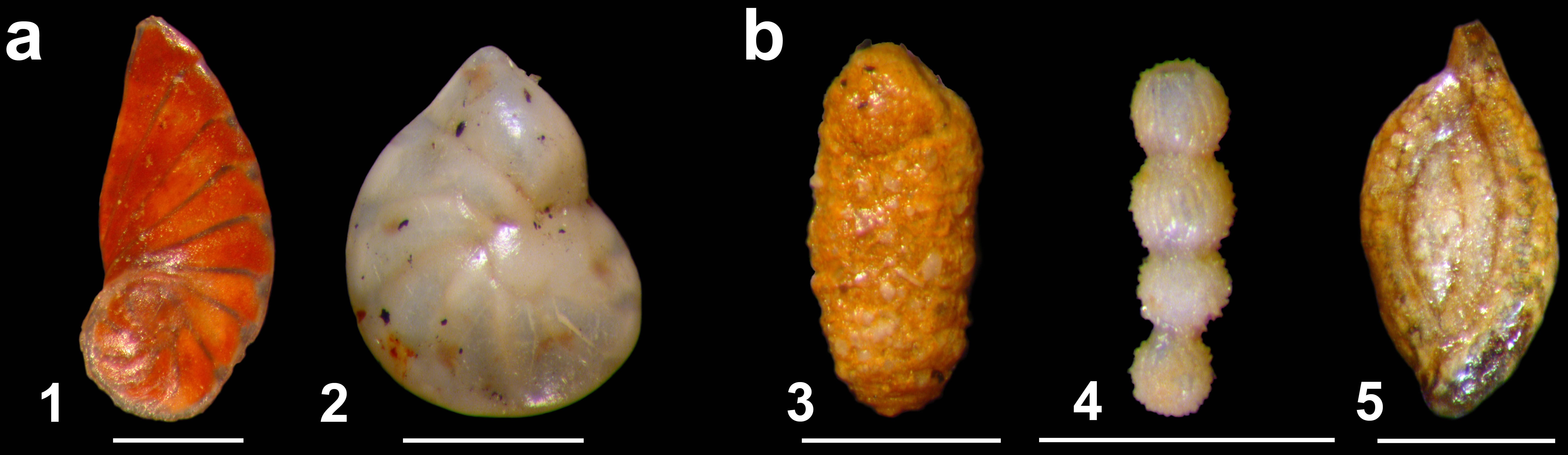 Howes collection of Foraminifera